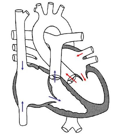 Normal Blood Flow